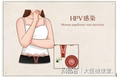 hpv52阳性一定是男人传染的吗