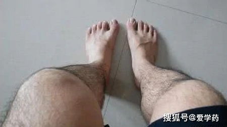 男生腿毛可以刮吗