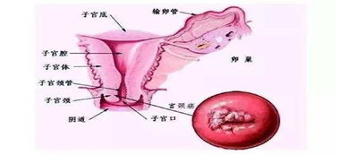 男人查hpv病毒怎么查