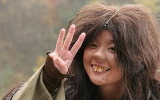 龅牙女人命运如何 龅牙的人命运怎么样